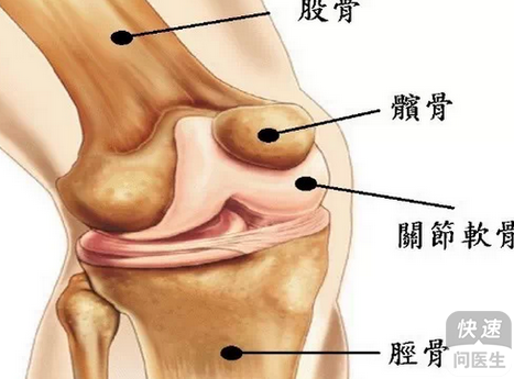 老人膝关节痛风石，成因、影响及防治策略与日常汤饮的关系探讨